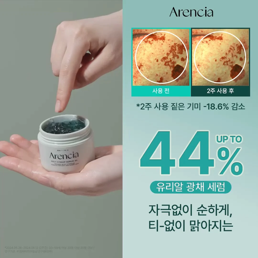 아렌시아 연관 소재